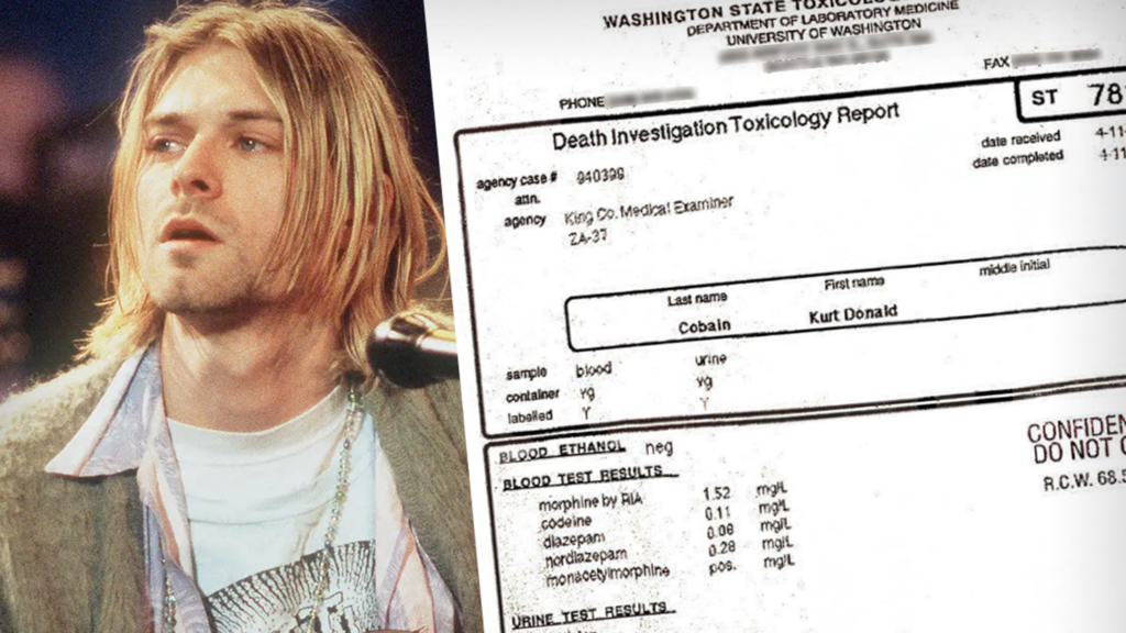 Kurt Cobain's Purported Autopsy Report Leaked, Details About Suicide