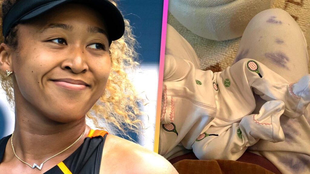 Naomi Osaka's Baby Daughter Makes Magazine Debut