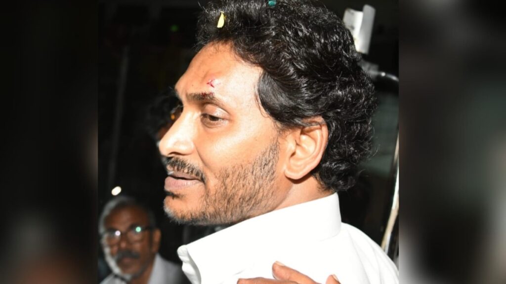 Andhra Chief Minister Jagan Mohan Reddy injured after stones thrown during Vijayawada roadshow